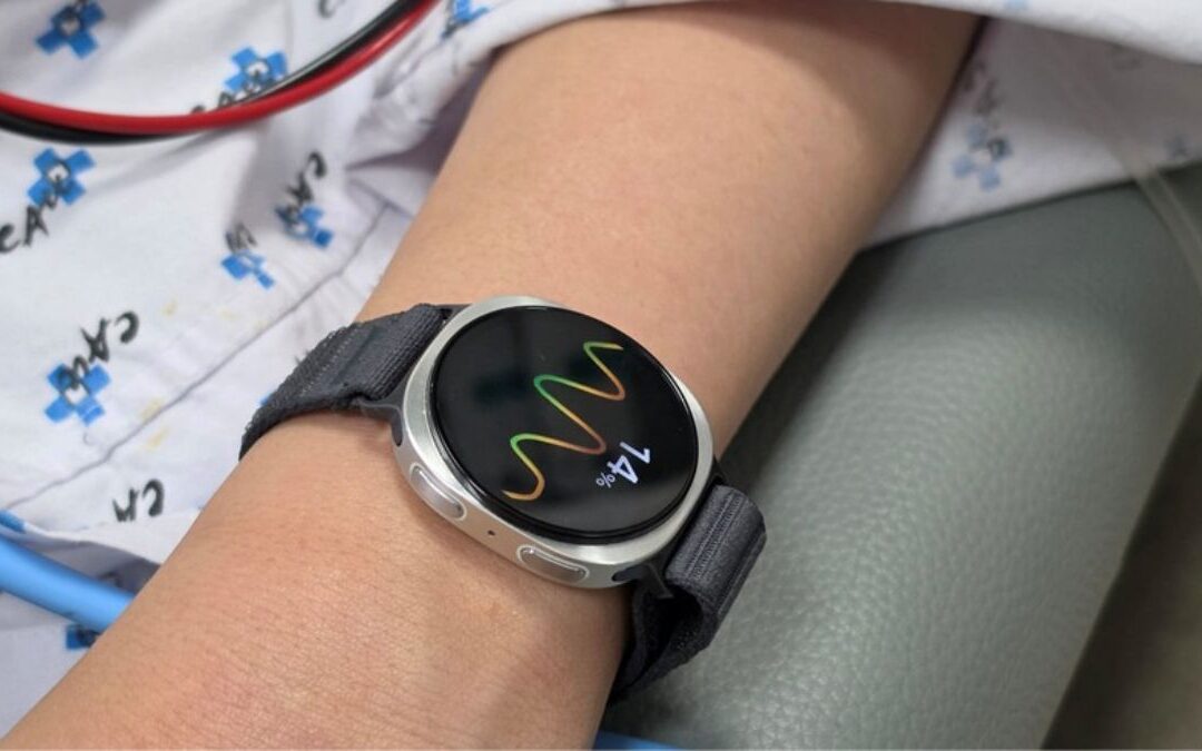 Future Galaxy Watches May Predict Fainting Before It Happens